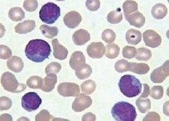 �������ܰ�ϸ�����ԶԿ����ʪ�Թؽ�����