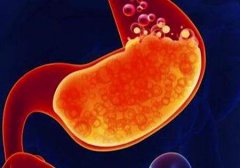 ��5���˸�Ⱦ���������˾��Ⱥ���4��ˮɱ����θ��֢������