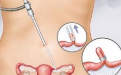 ����Ӧ�������˻�����Ů������ô����