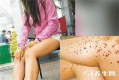 �Թ�Ů����Ⱦ÷�������̲���ֻ��Ů�˶���������Щ�¡���