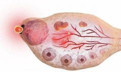 �¾��ߺ����ǡ������ڡ��������������3�����о�����׼ȷ