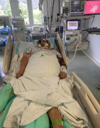 广东32岁快递员患热射病住进ICU，昏迷一个多月仍未醒